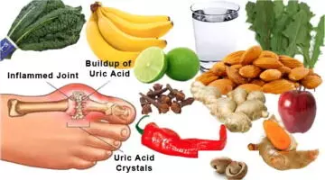 Understanding Uric Acid: symptoms, causes, and remedies Understanding Uric Acid: symptoms, causes, and remedies