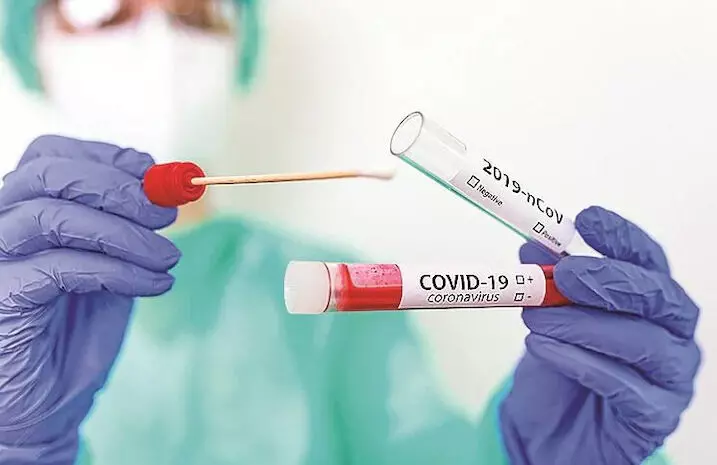 Two new COVID-19 cases reported in Itanagar Two new COVID-19 cases reported in Itanagar