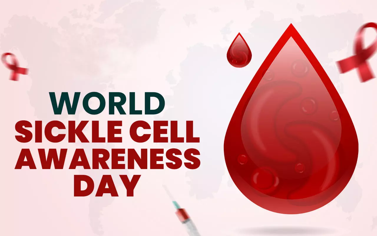 World Sickle Cell Day: A global call for awareness and compassion World Sickle Cell Day: A global call for awareness and compassion