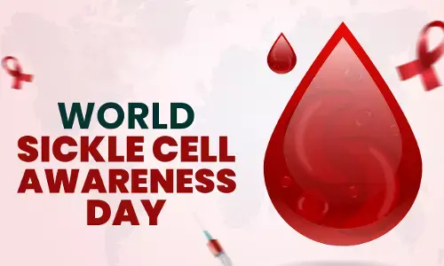 World Sickle Cell Day: A global call for awareness and compassion World Sickle Cell Day: A global call for awareness and compassion
